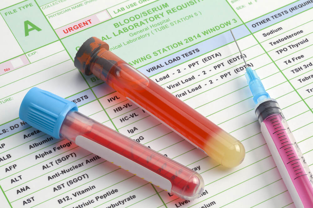 Blood sample vials and syringe on a laboratory requisition form, representing pet blood work diagnostics in San Diego