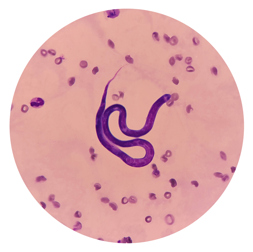 Microscope slide showing a heartworm microfilaria in a blood sample, representing heartworm disease prevention in San Diego
