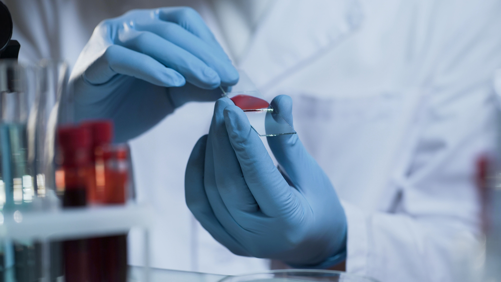 Lab technician in blue gloves preparing a blood sample slide, representing in-house veterinary diagnostics in San Diego